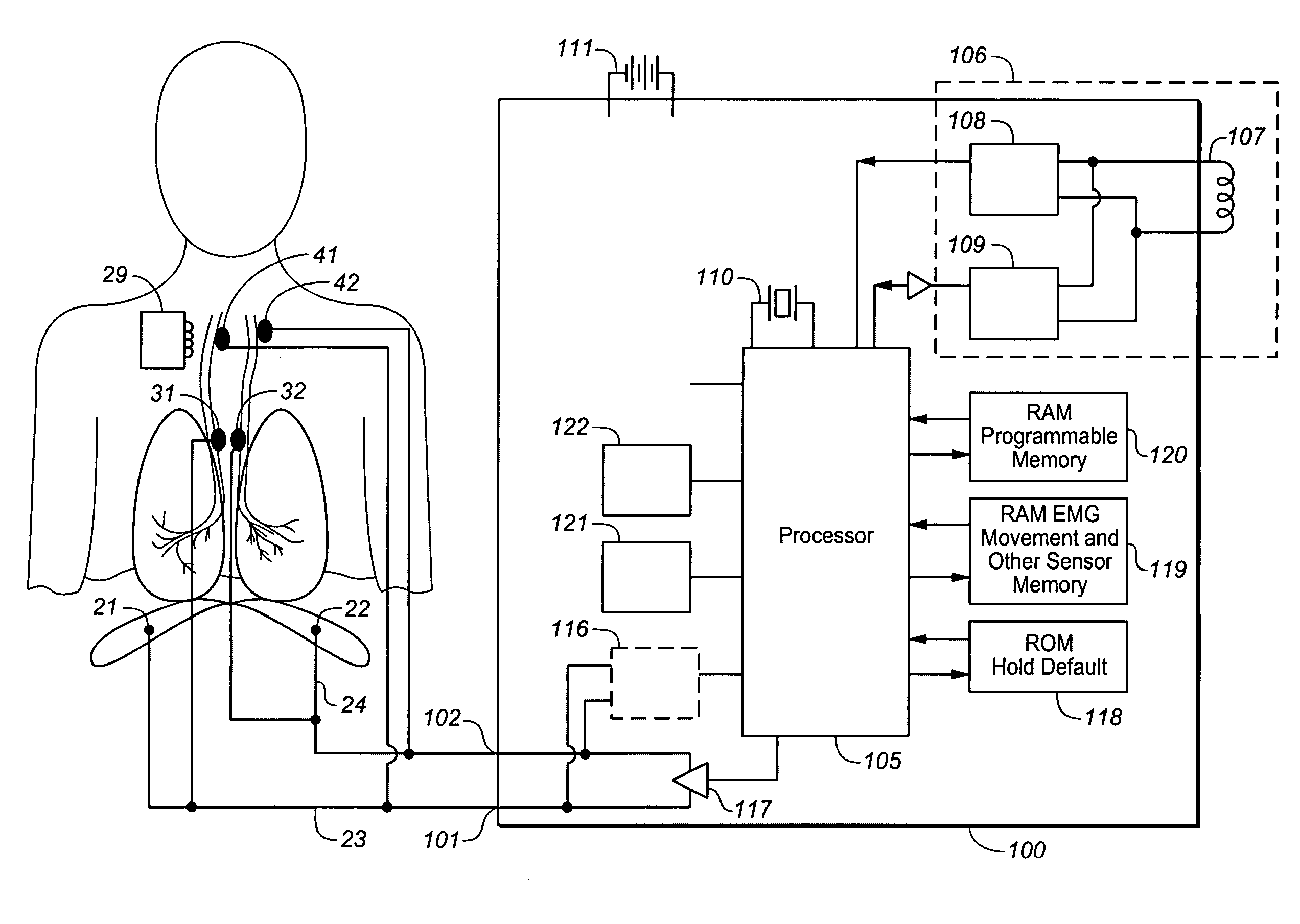 Device and method for treating obstructive sleep apnea