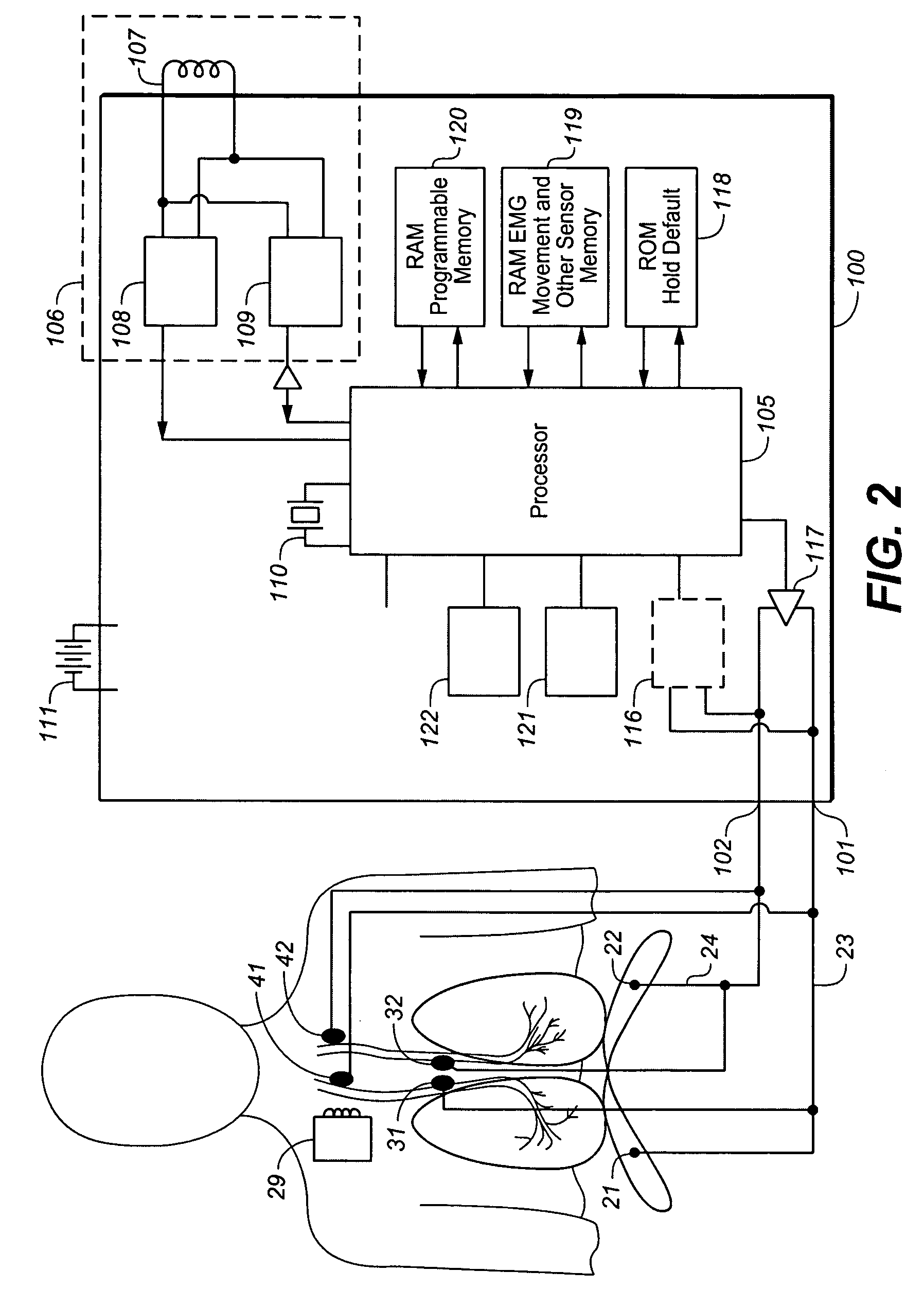 Device and method for treating obstructive sleep apnea