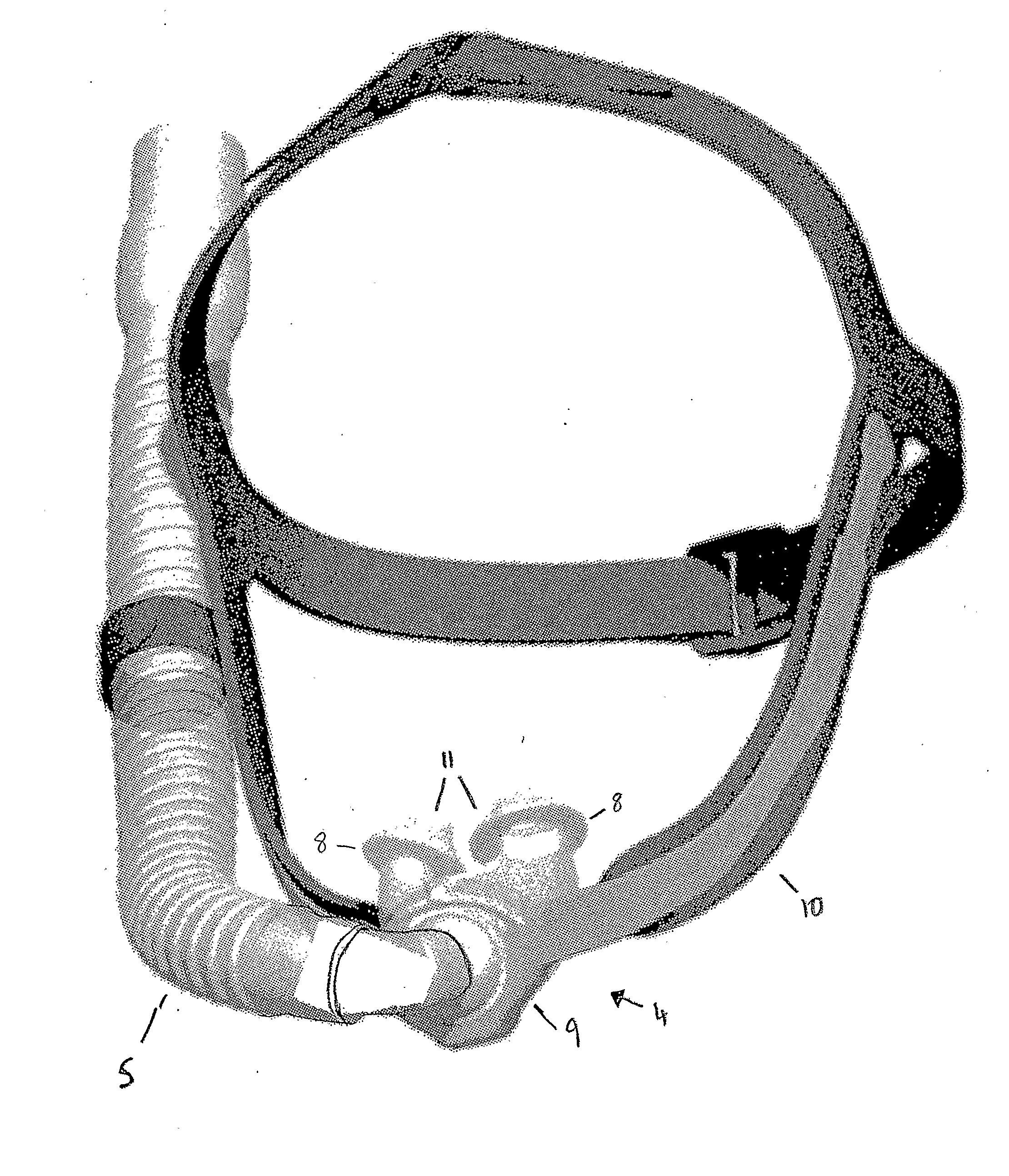 Nasal pillows with high volume bypass flow and method of using same