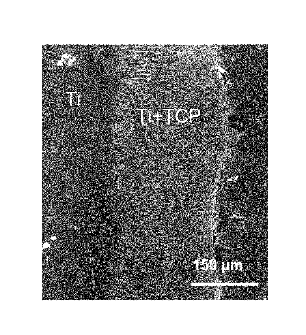 Modified metal materials, surface modifications to improve cell interactions and antimicrobial properties, and methods for modifying metal surface properties