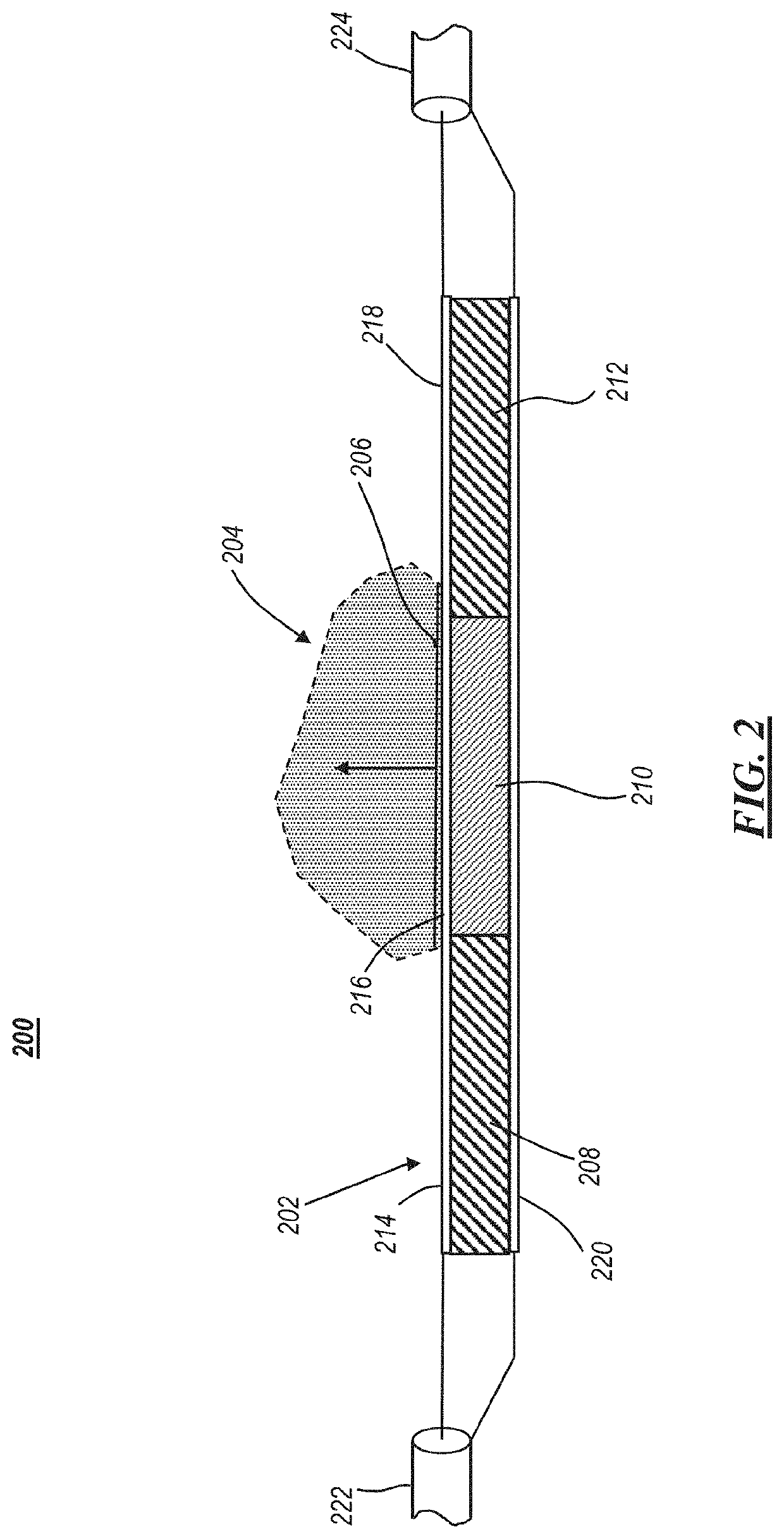 Apparatus for in vivo dielectric spectroscopy