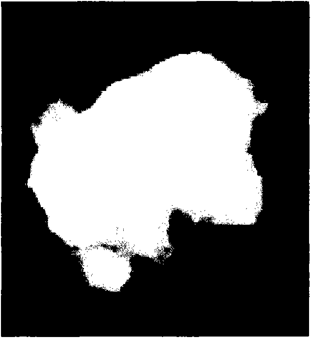 Method for extracting multi-dimensional texture of nodi from medical images