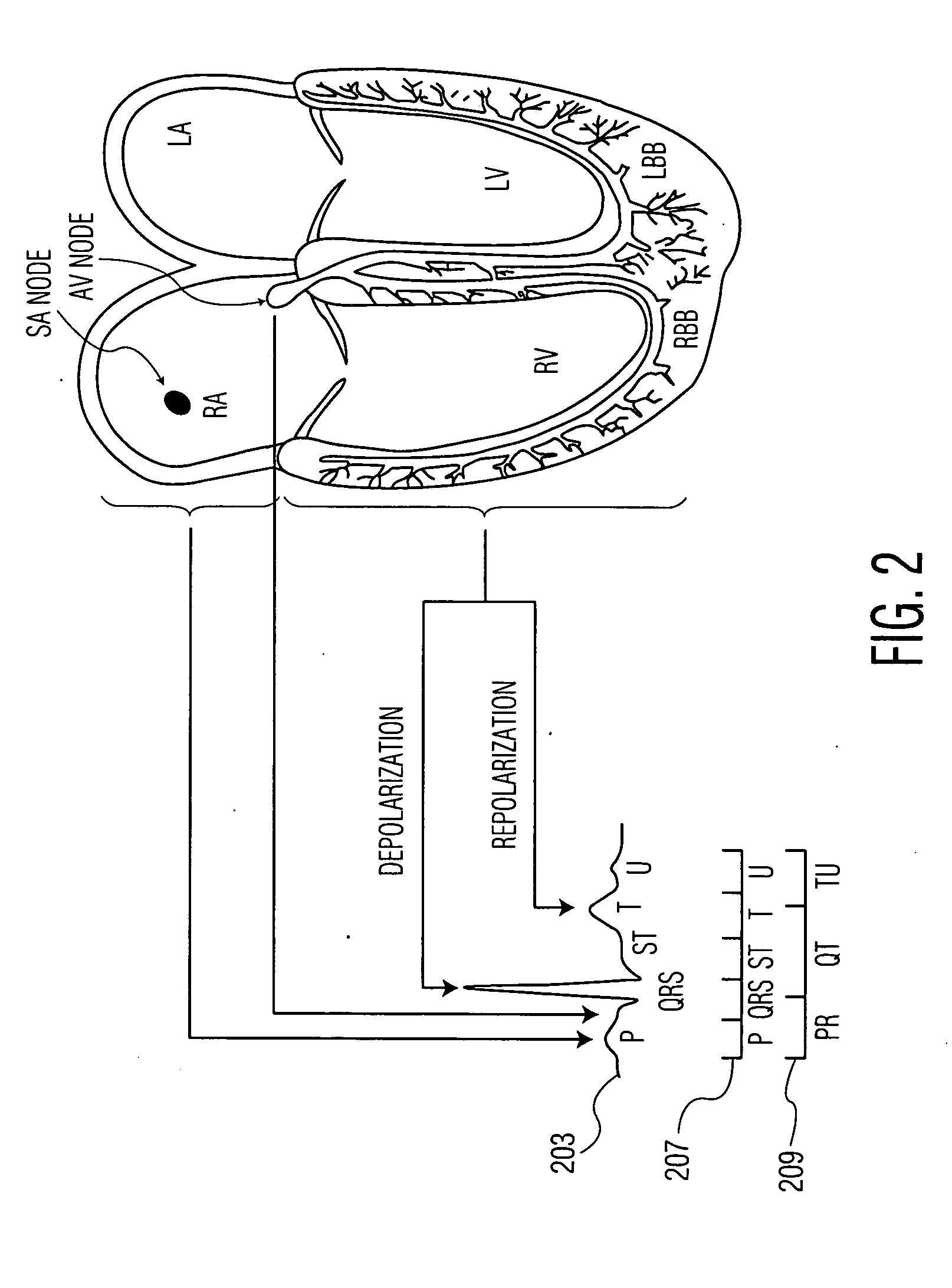 System for Heart Performance Characterization and Abnormality Detection