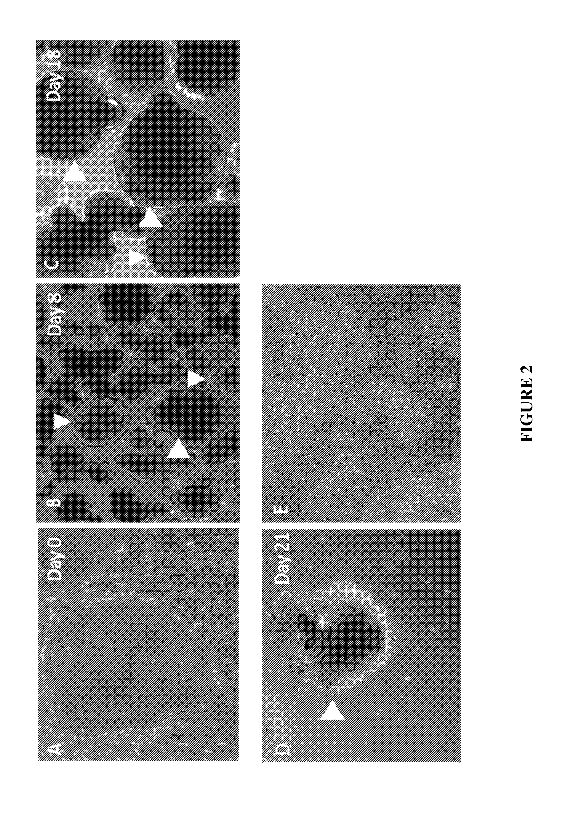 Method of in vitro differentiation of motor neuron progenitors (MNPS) from human induced pluripotent stem cells and cryopreservation of mnps