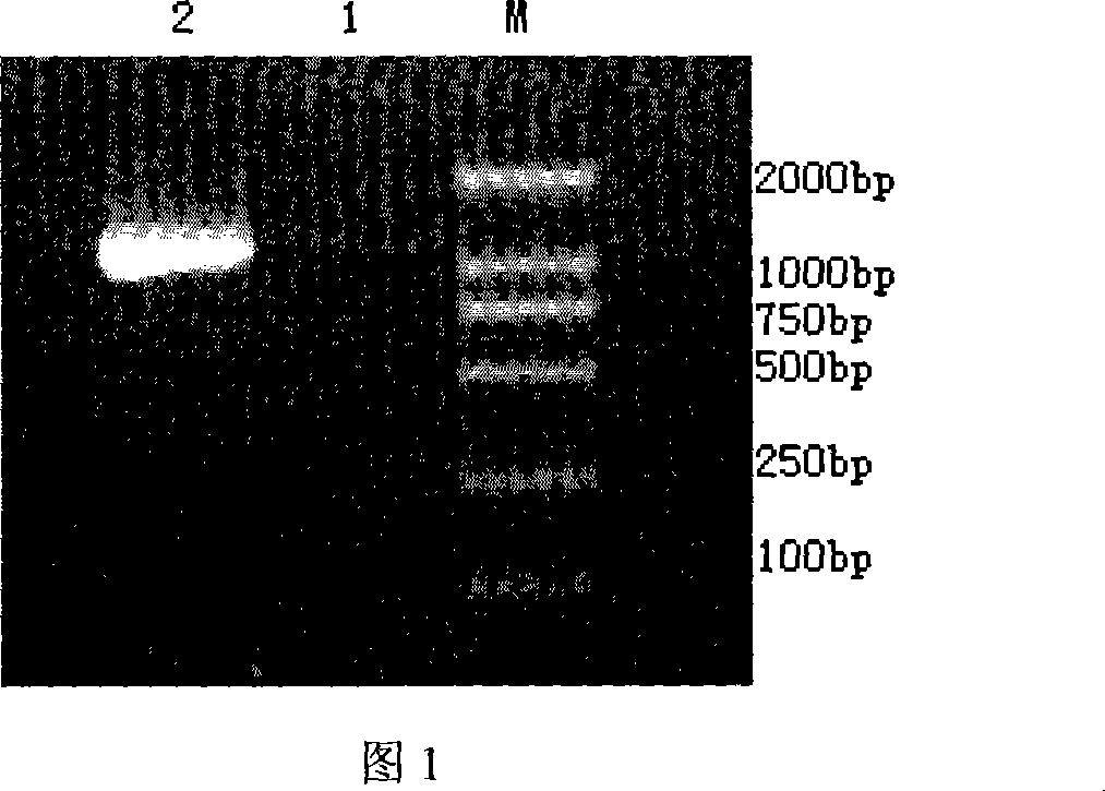 Streptococcus pneumonia autoenzyme protein and its protocaryon expression purification technique and vaccine