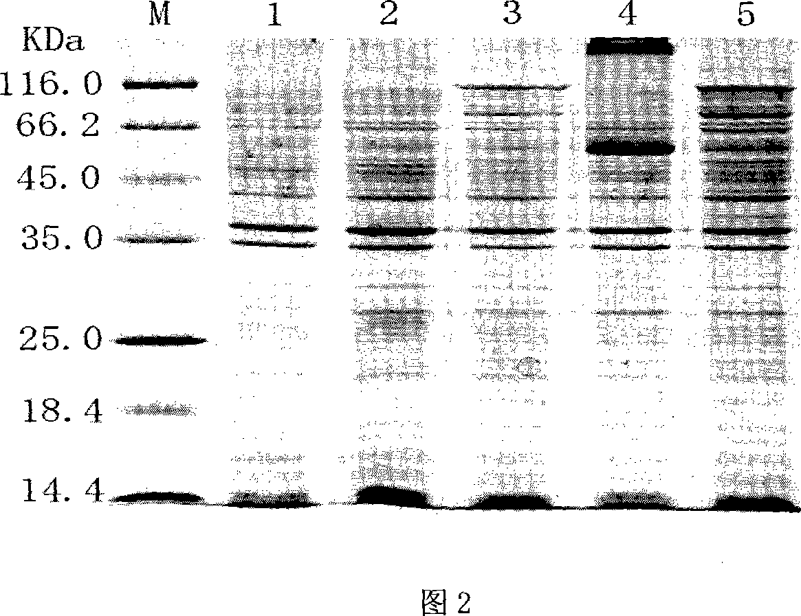 Streptococcus pneumonia autoenzyme protein and its protocaryon expression purification technique and vaccine