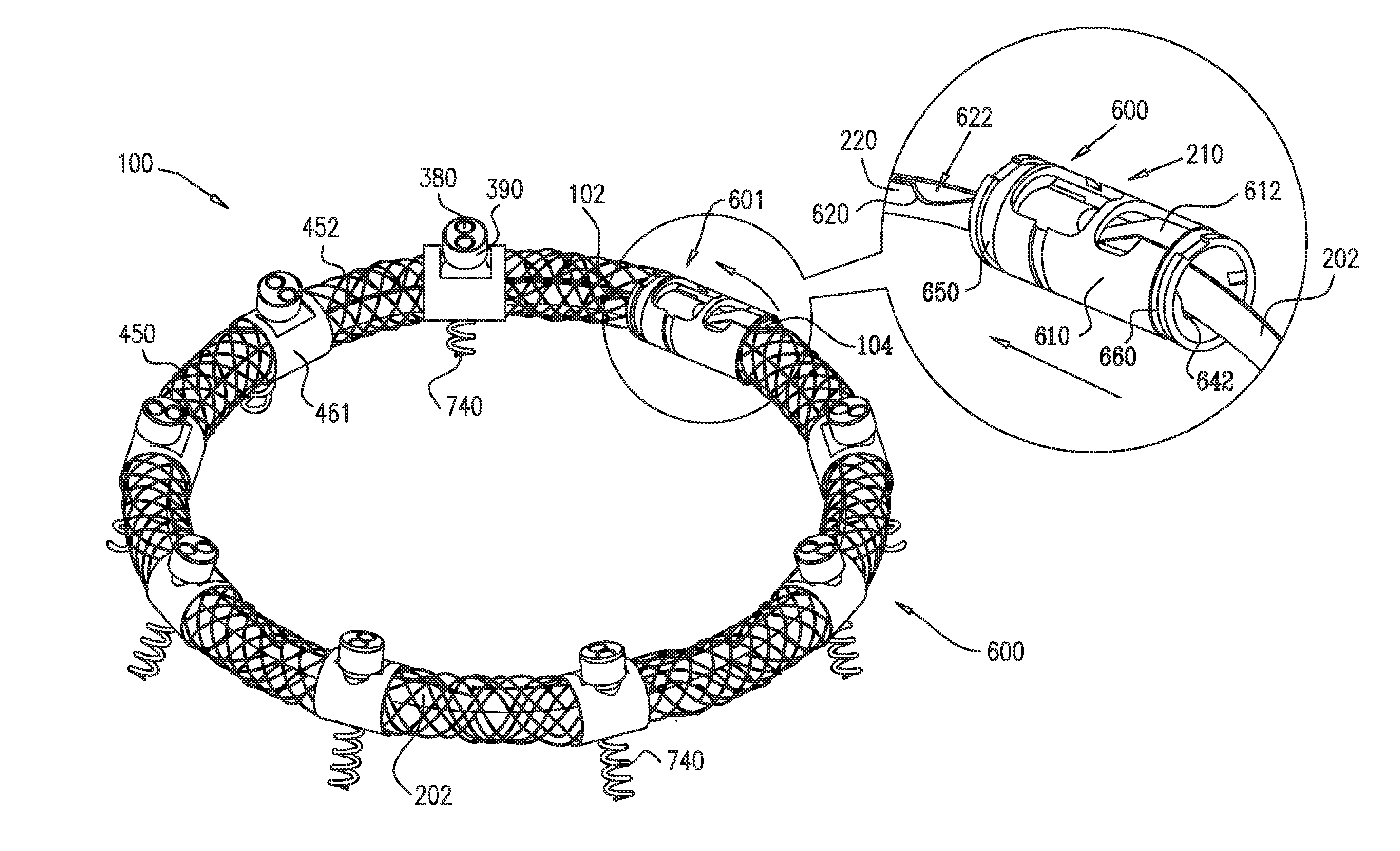 Implantation of repair devices in the heart