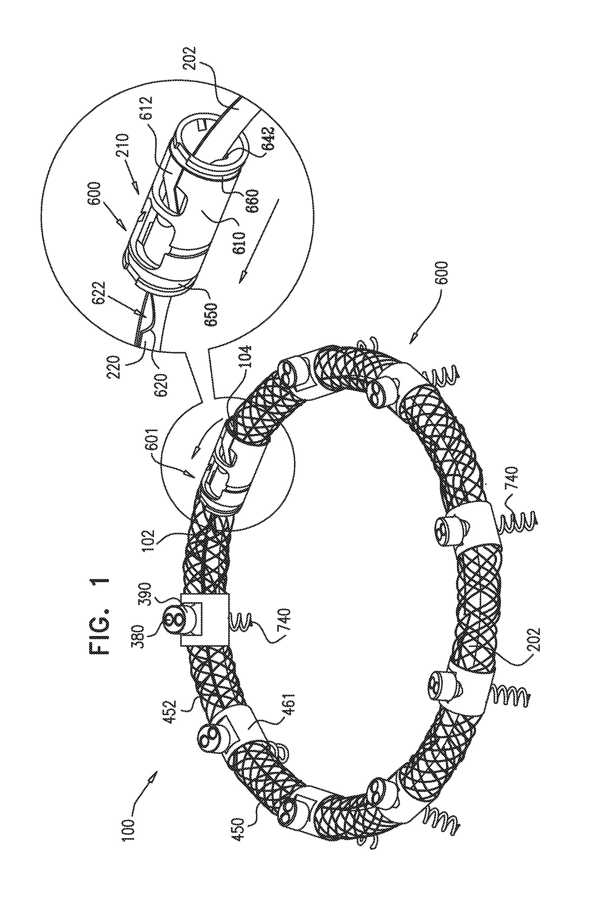 Implantation of repair devices in the heart