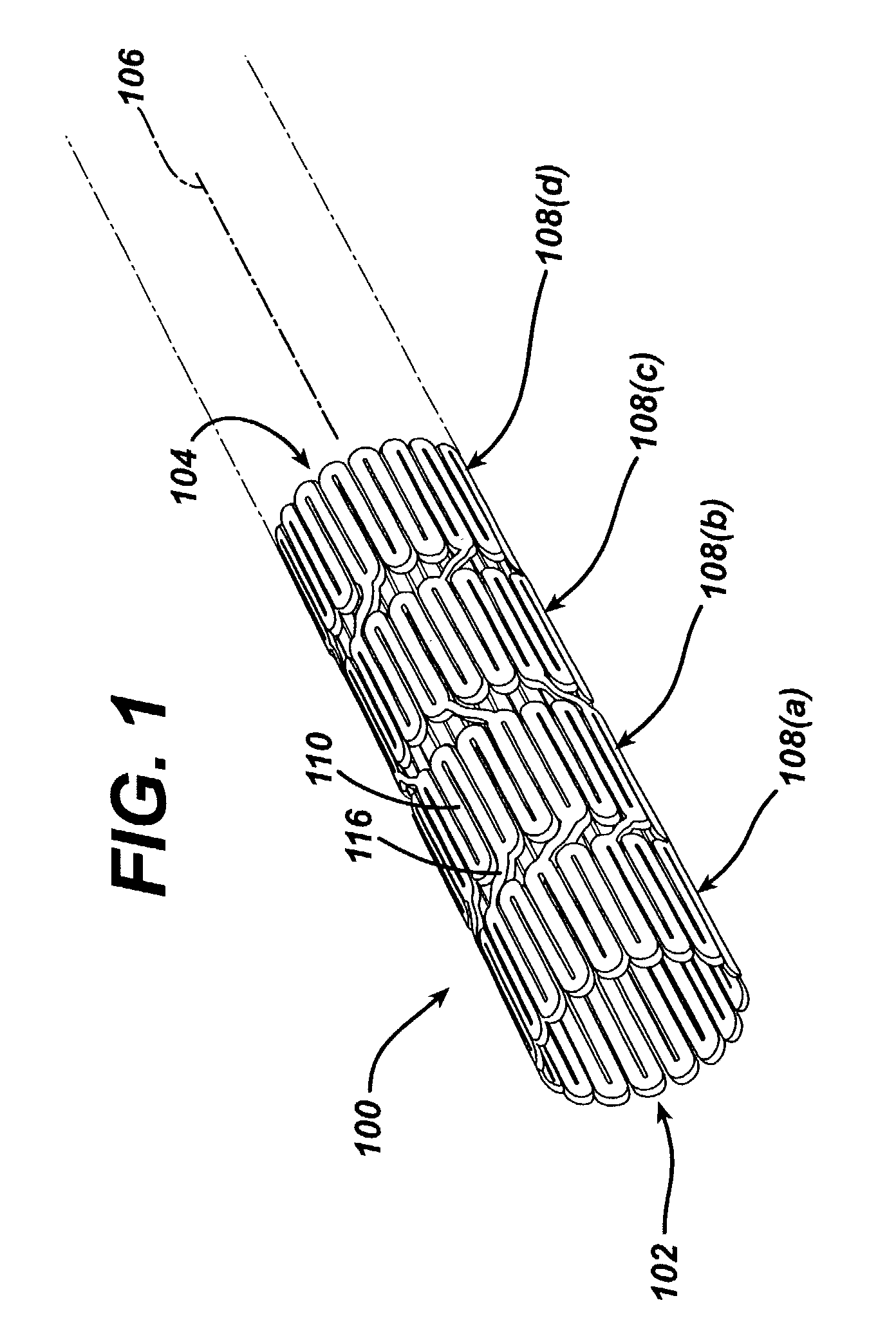 Split-bridge stent design