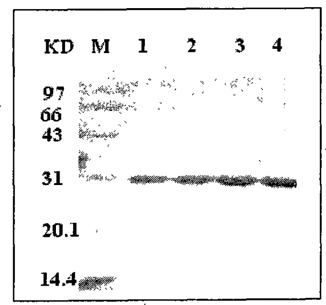 Anthropogenic antivirulin glycosidoprotein neutralizing genetic engineering antibody RD9 and preparation and application thereof