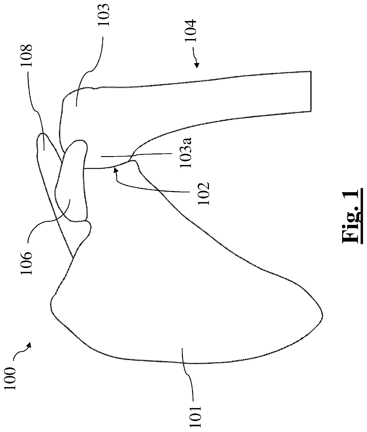 Method for surgical application of a glenoid prosthesis component of a shoulder joint prosthesis and relating surgical instruments