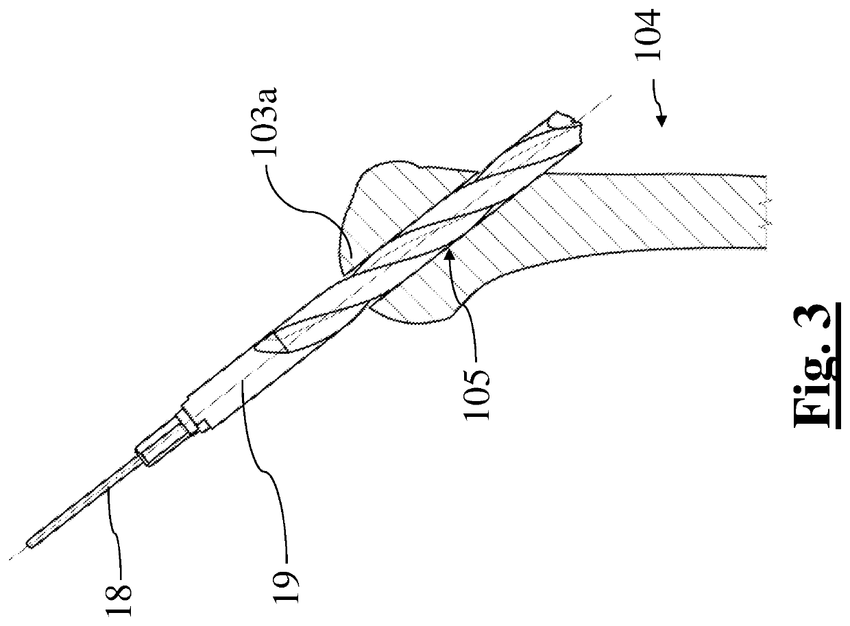 Method for surgical application of a glenoid prosthesis component of a shoulder joint prosthesis and relating surgical instruments