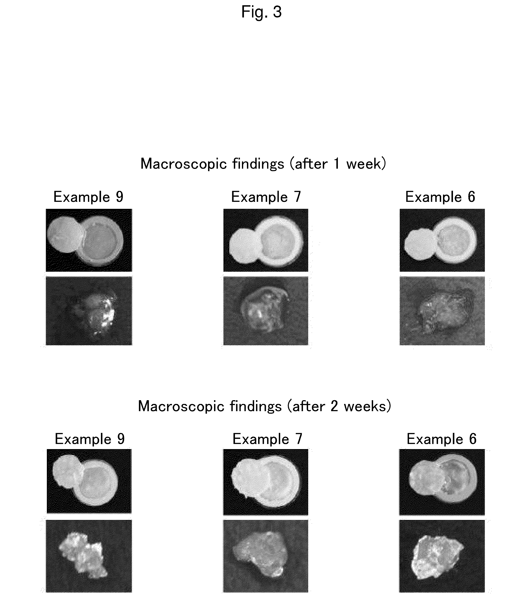 Material for preventing tissue adhesion and material for preventing joint contracture