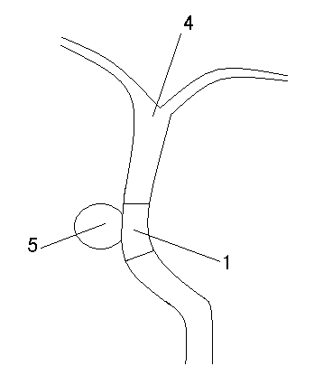 Coating film capable of adhering or directly adhering on blood vessel