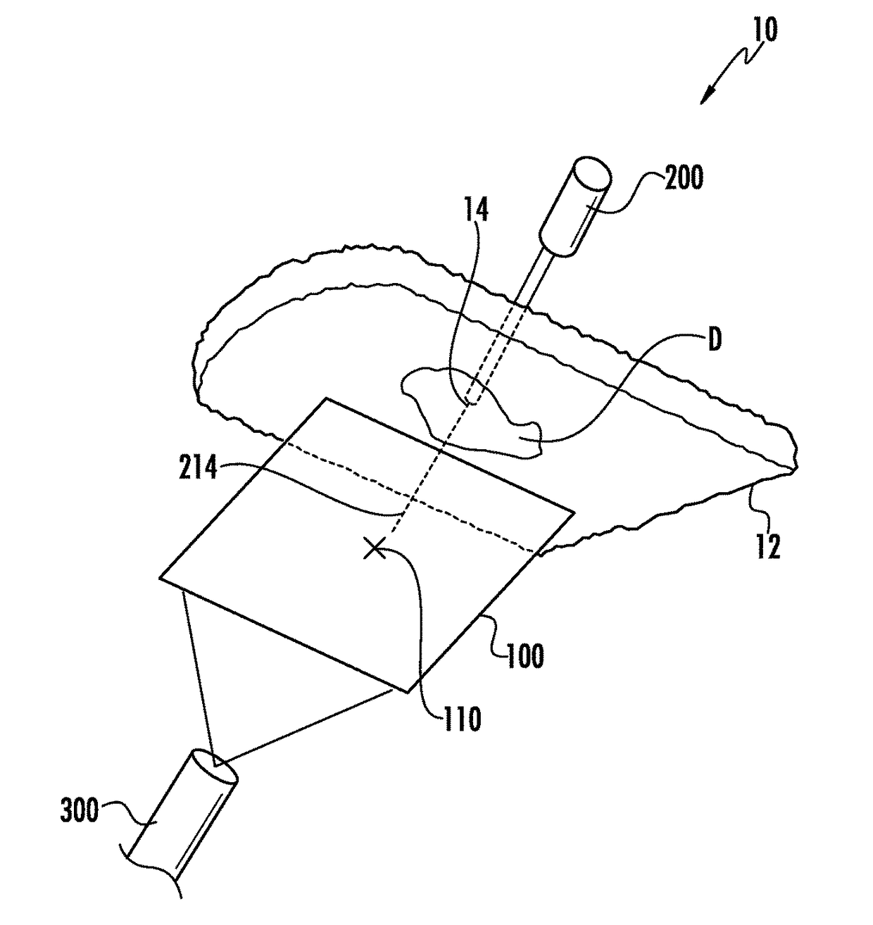 Hernia mesh placement system and method for in-situ surgical applications