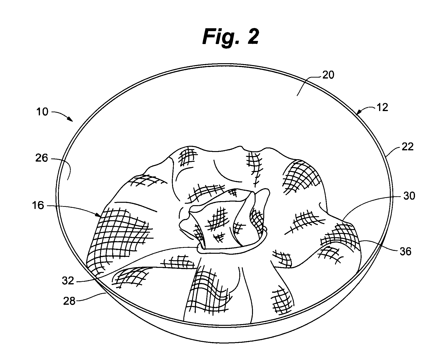 Cartridge assembly having an integrated retention system