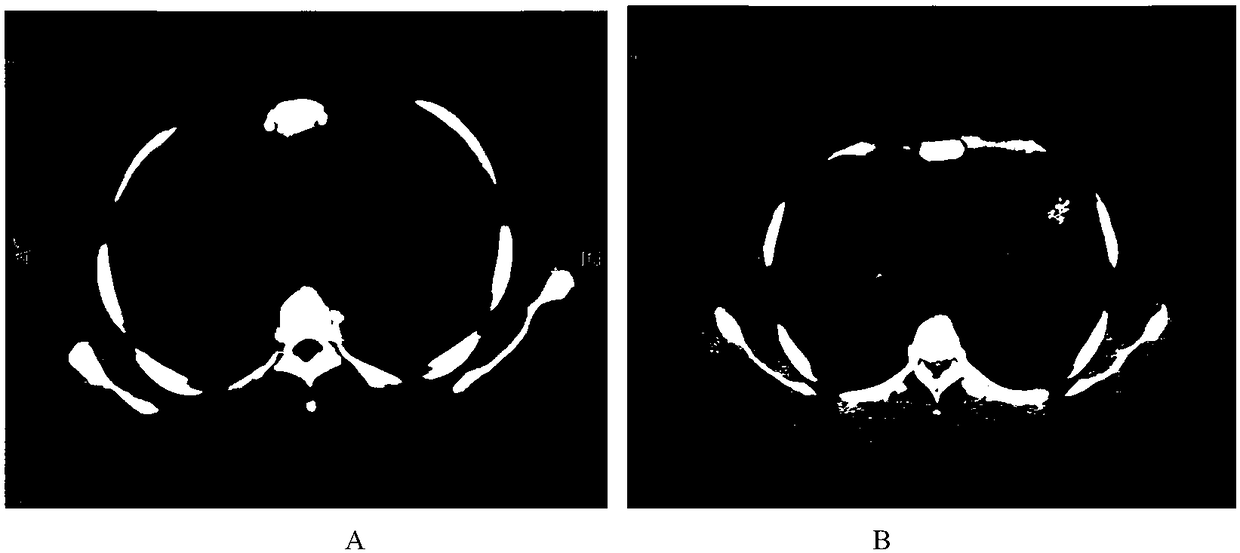 Antigen peptide chain group for treating tumor and application thereof to medicine