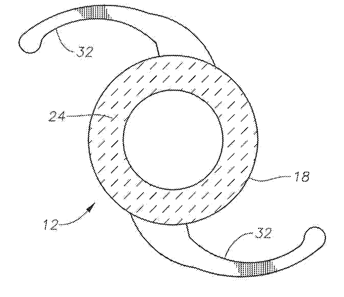 Intraocular lenses with interlenticular opacification resistance