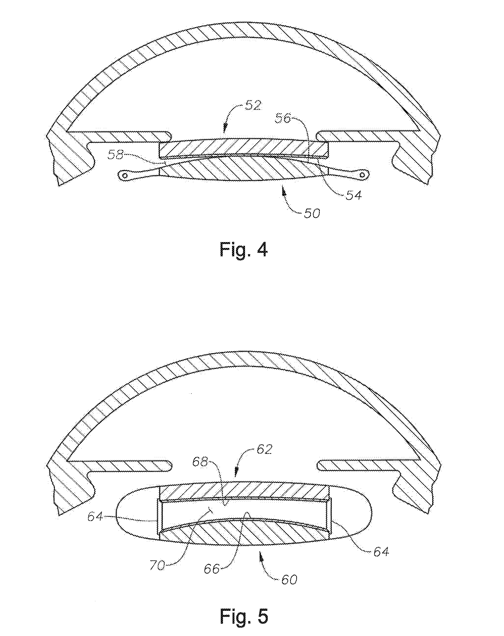 Intraocular lenses with interlenticular opacification resistance