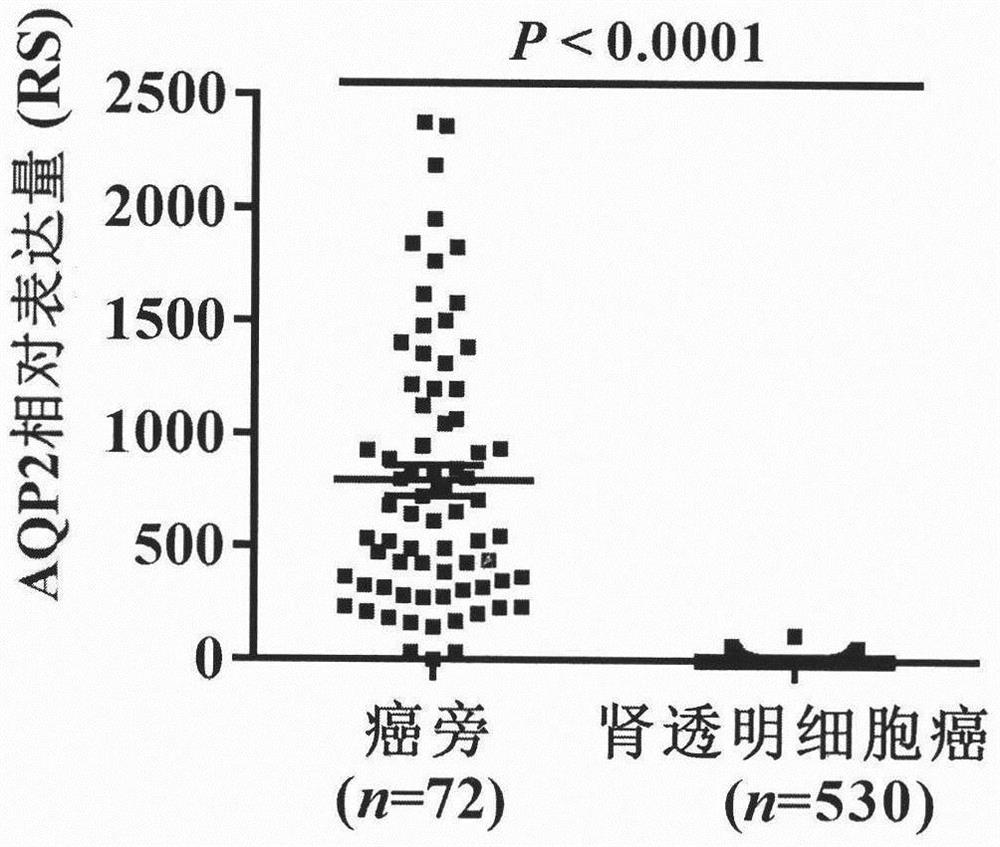 Tumor marker AQUAPORIN2 protein and application thereof