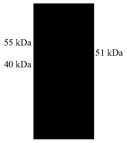 DEV gB protein monoclonal antibody and blocking ELISA kit for detecting DEV antibody