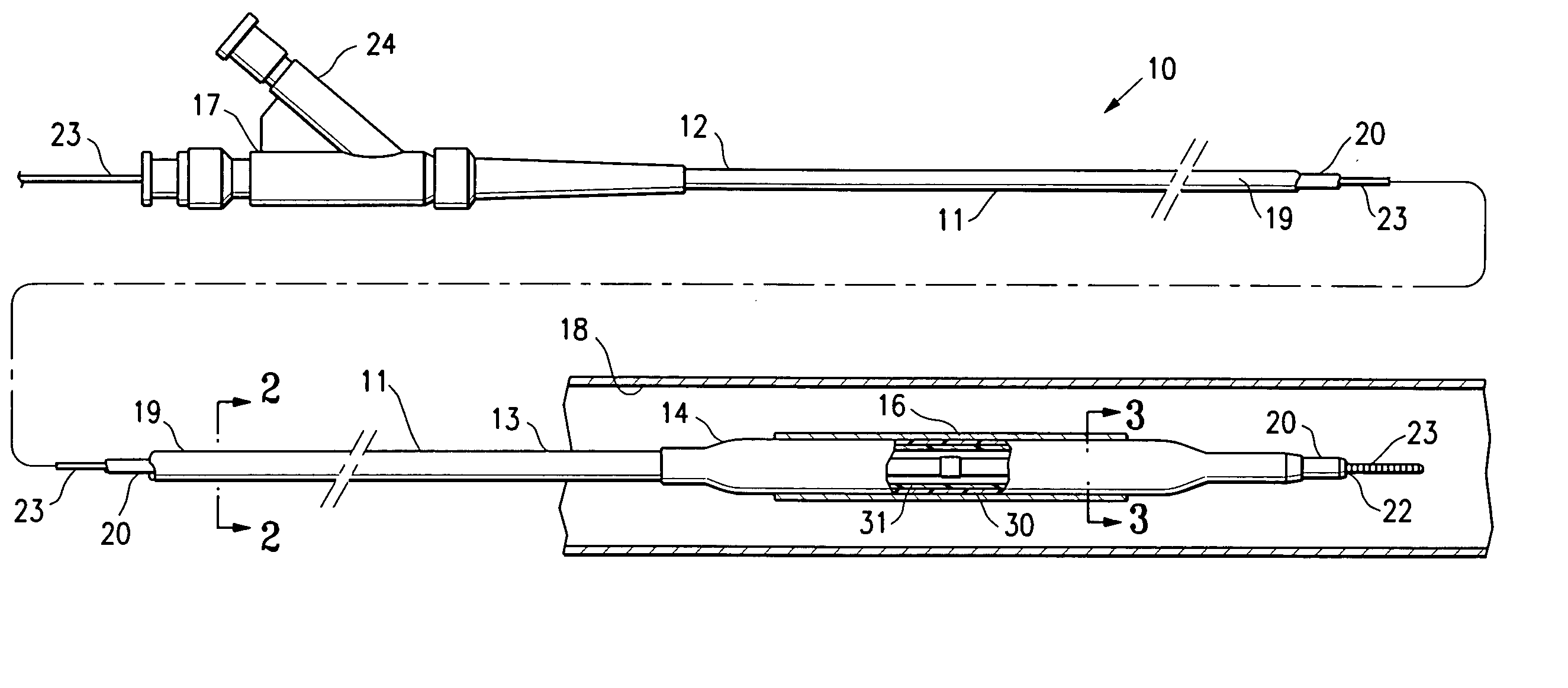 Non-compliant multilayered balloon for a catheter