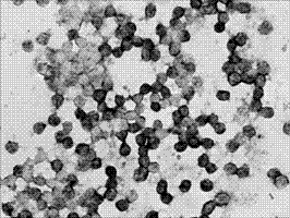 AGPS gene mRNA level in-situ hybridization detection kit, detection method and applications thereof