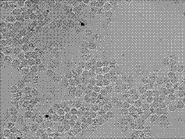 AGPS gene mRNA level in-situ hybridization detection kit, detection method and applications thereof