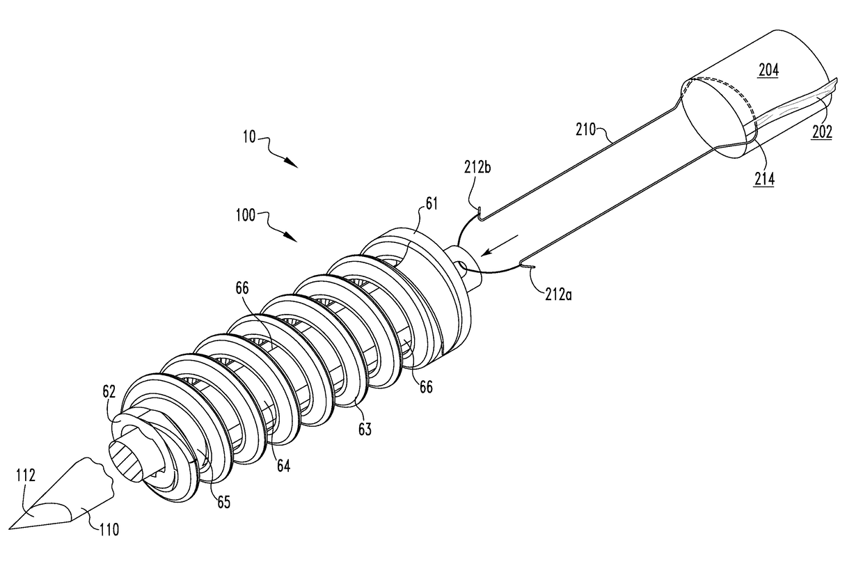 Ligament reconstruction fixation system