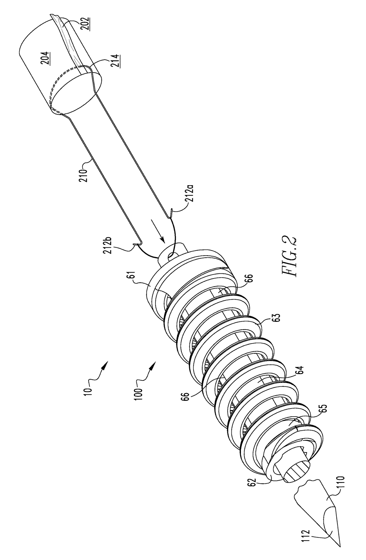 Ligament reconstruction fixation system