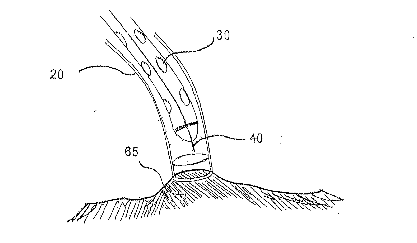 Systems and methods for localization of a puncture site relative to a mammalian tissue of interest