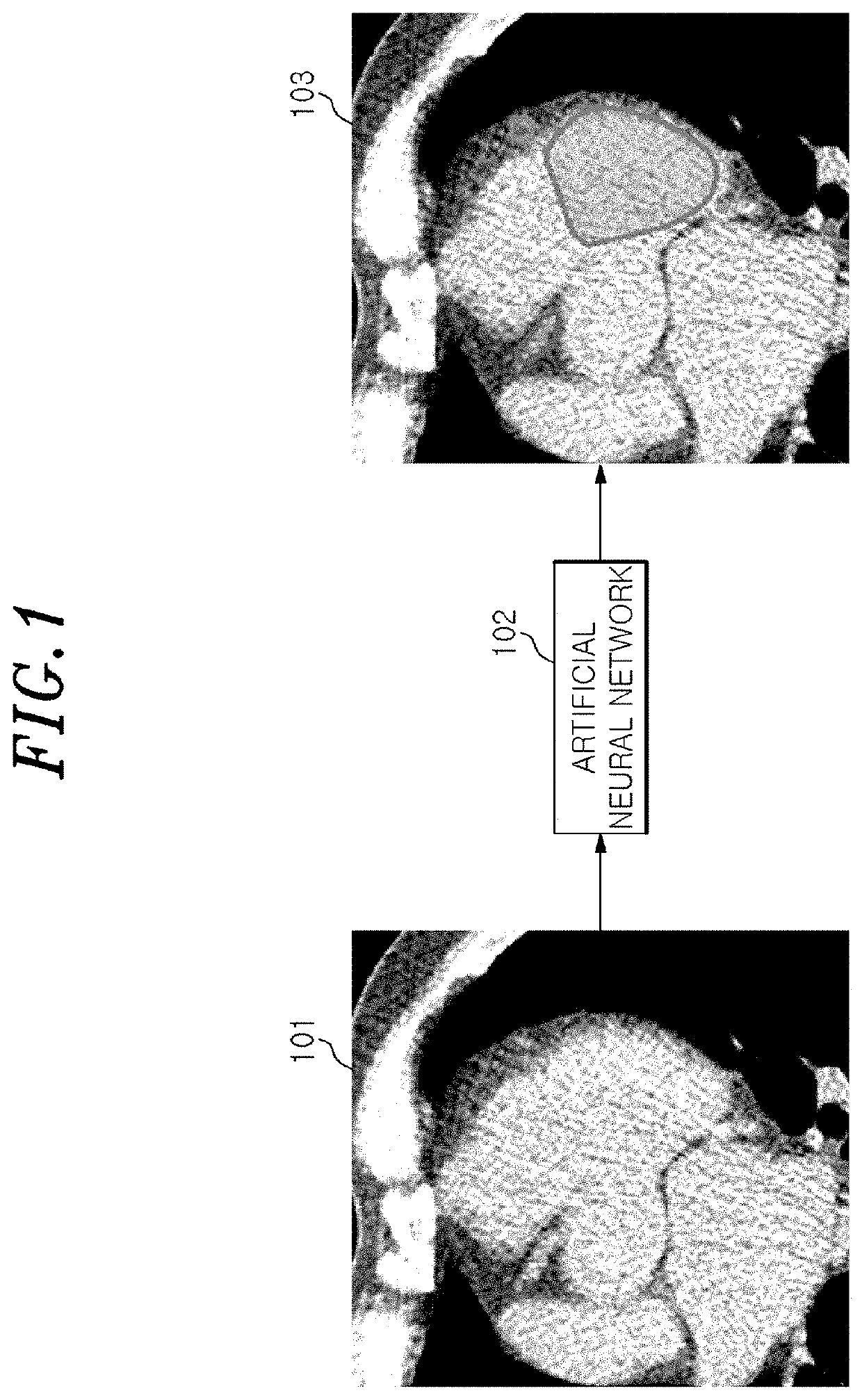 Method and apparatus for calculating coronary artery calcium score