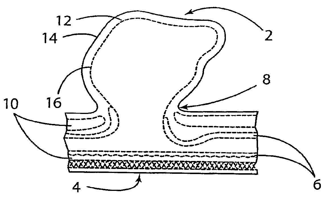 Method for non-invasive detection and treatment of cerebral aneurysms