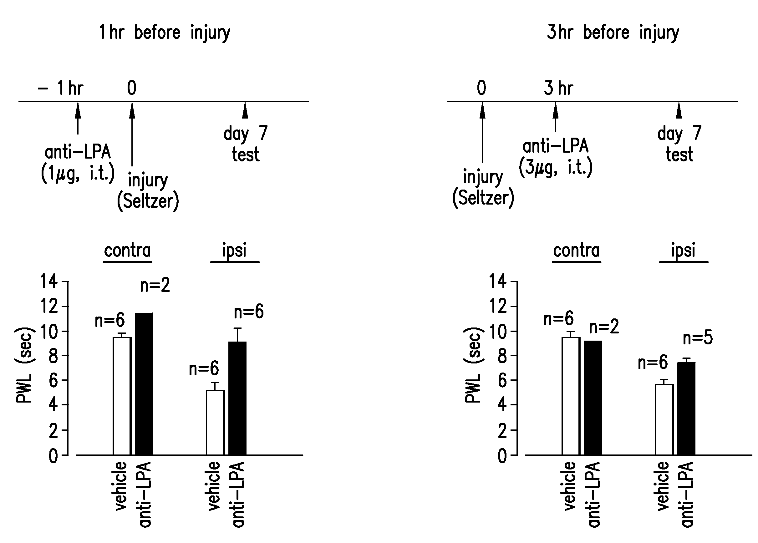 Prevention and treatment of pain using antibodies to lysophosphatidic acid