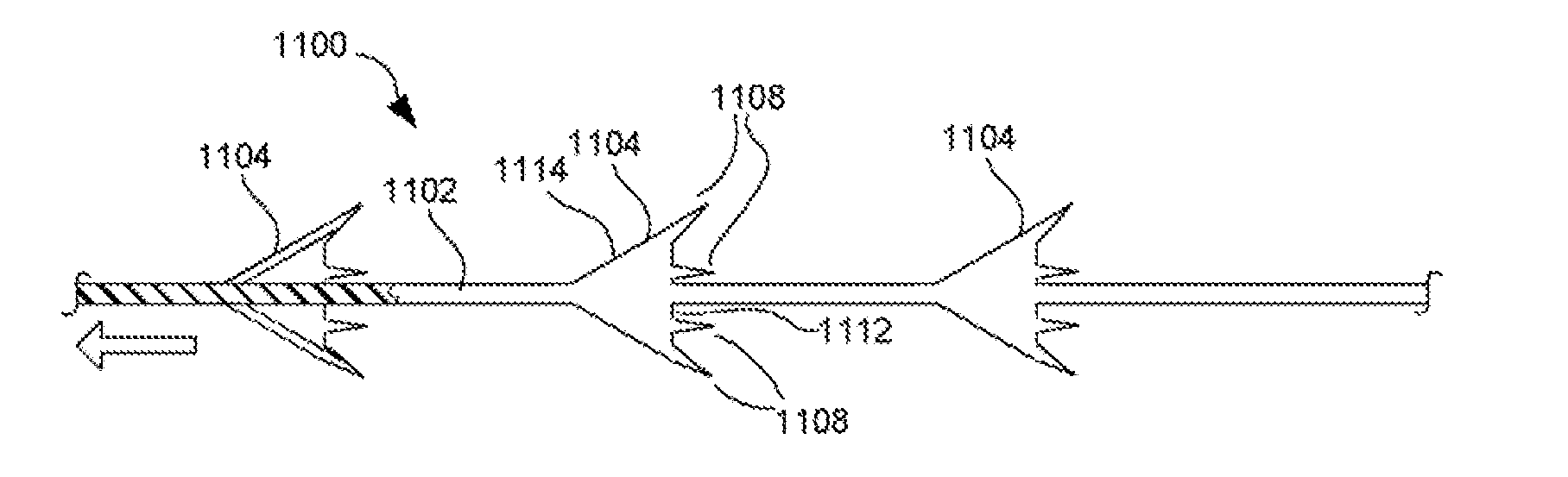 Self-retaining sutures with bi-directional retainers or uni-directional retainers