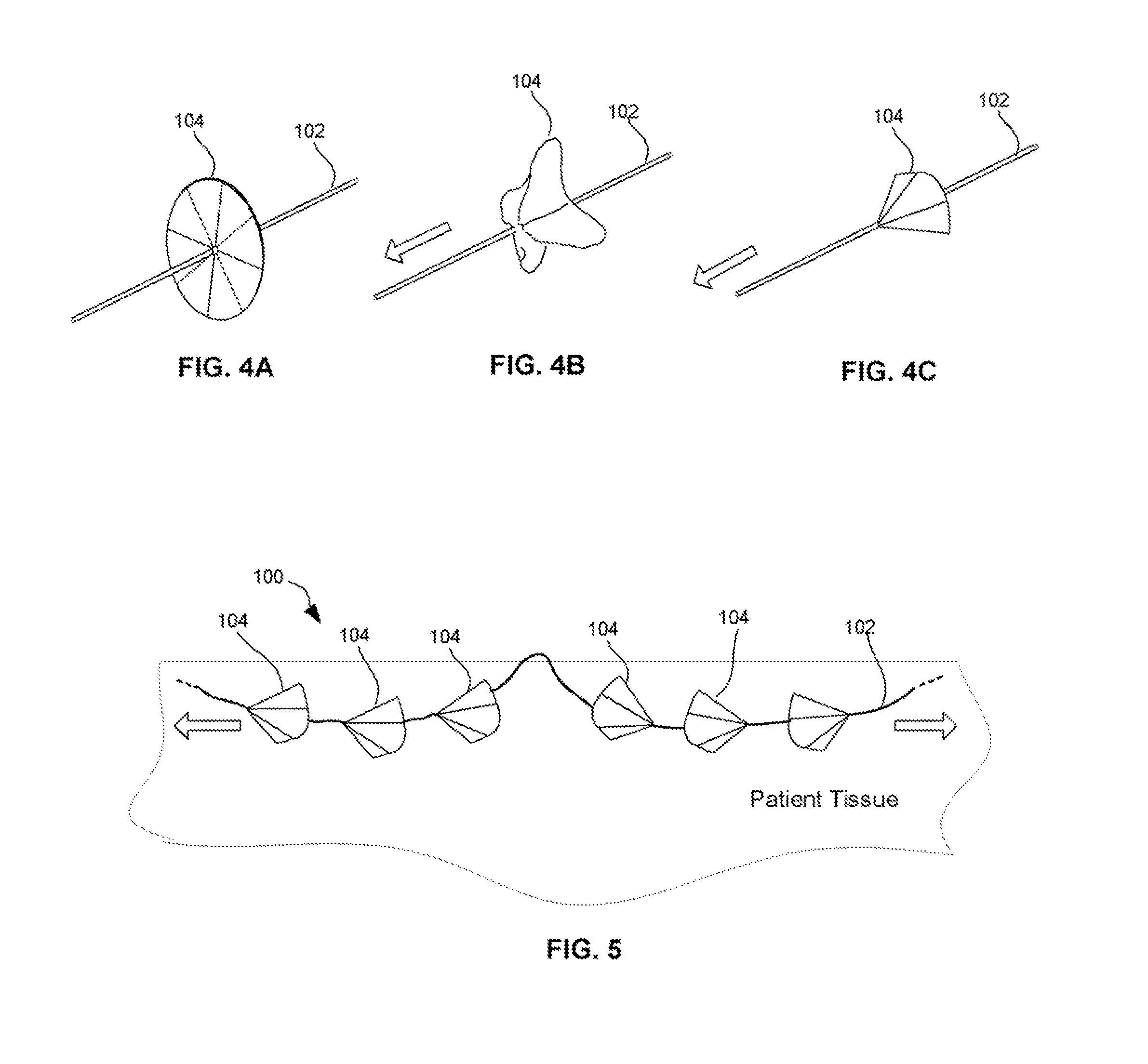 Self-retaining sutures with bi-directional retainers or uni-directional retainers