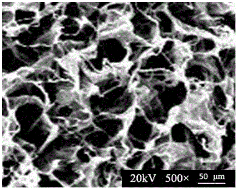 Scaffold material capable of blood sugar induced controlled-release of drugs and used for periodontal treatment and preparation method thereof