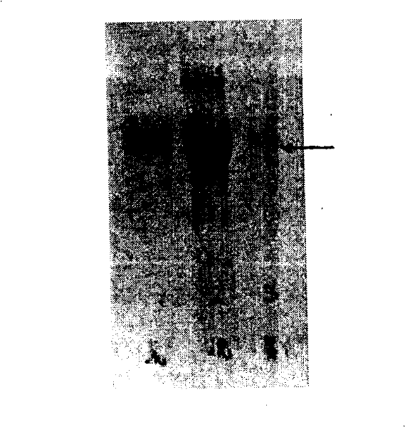 Fine purification method of polyvalent anti-snake venom freeze-dry blood serum