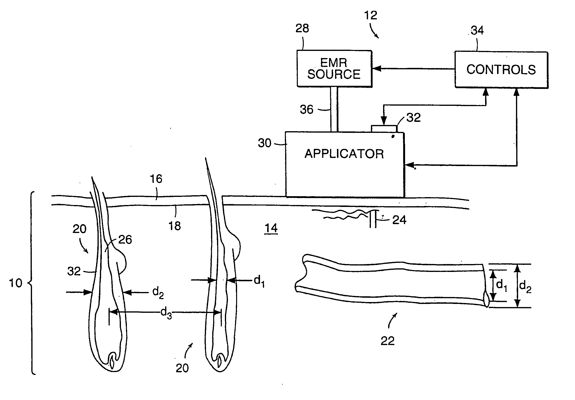 Method and apparatus for medical treatment utilizing long duration electromagnetic radiation