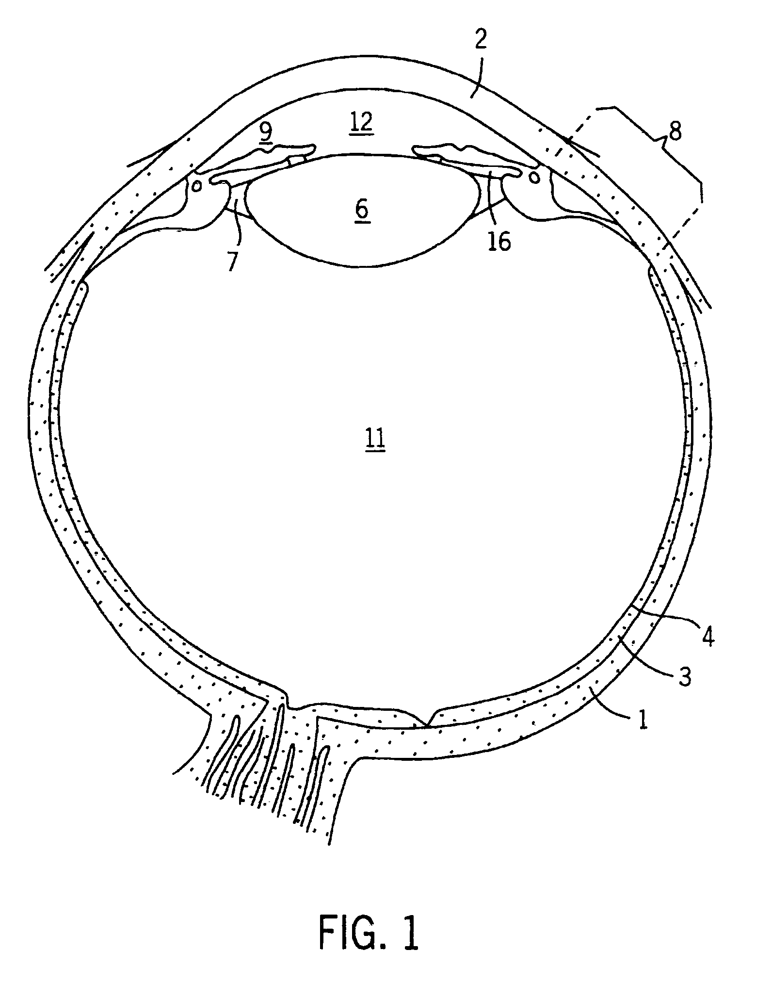 Implantable pump apparatuses