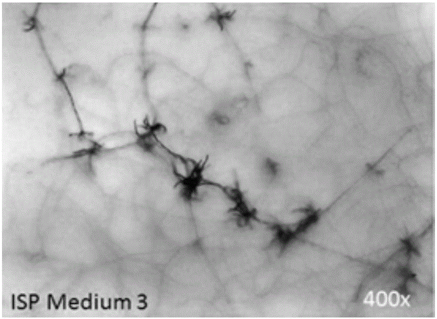 Separation and purification method of microbial transglutaminase