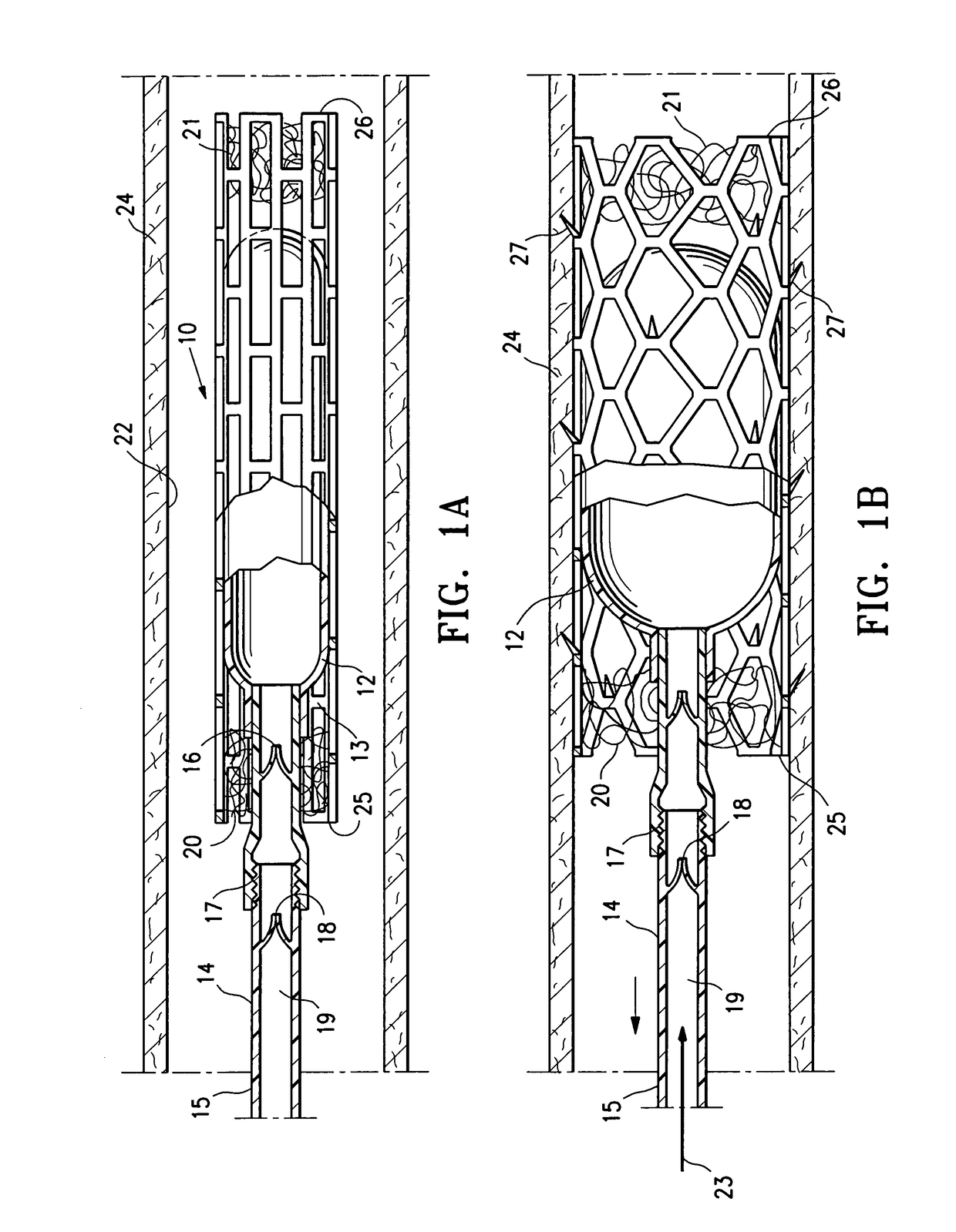 Contraceptive with permeable and impermeable components