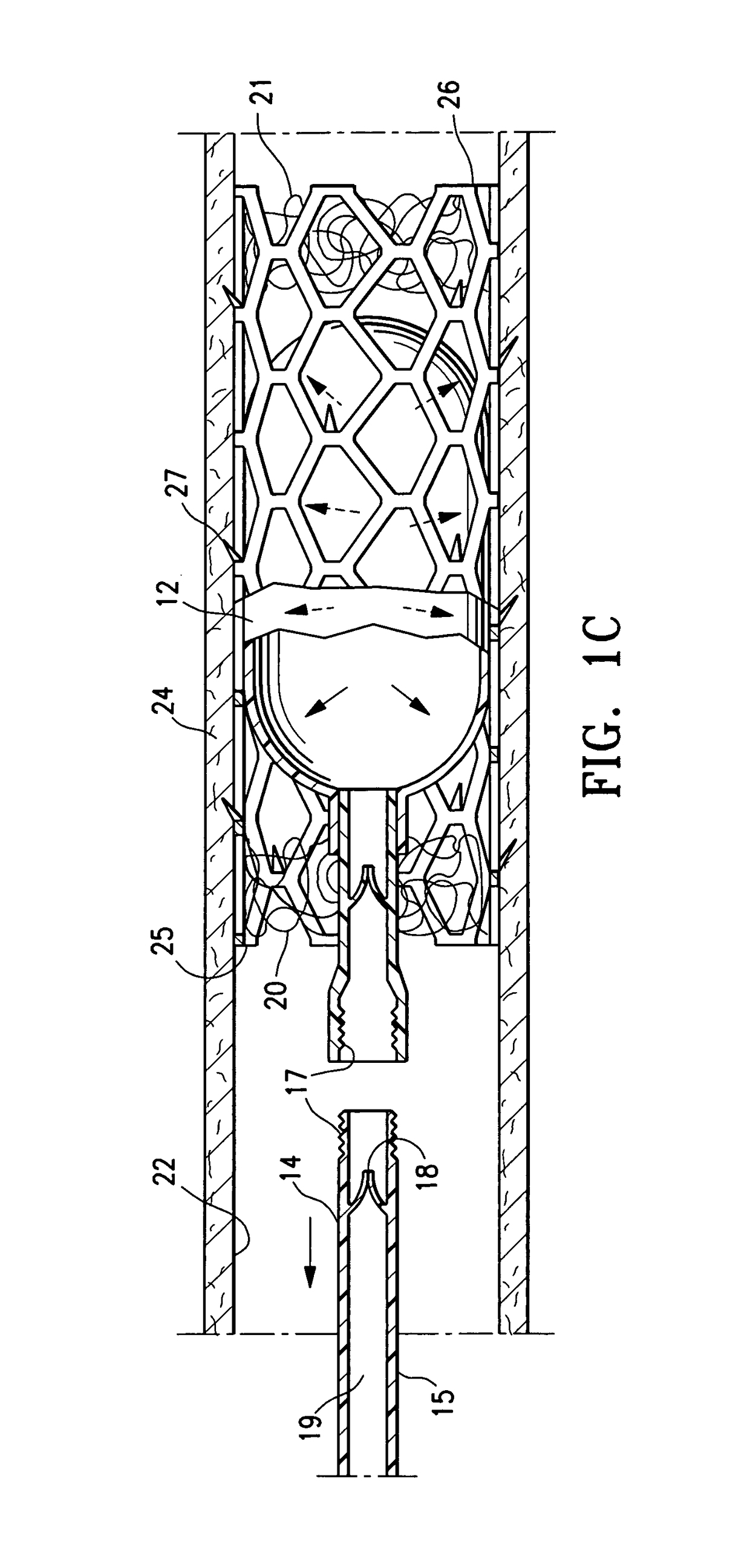 Contraceptive with permeable and impermeable components