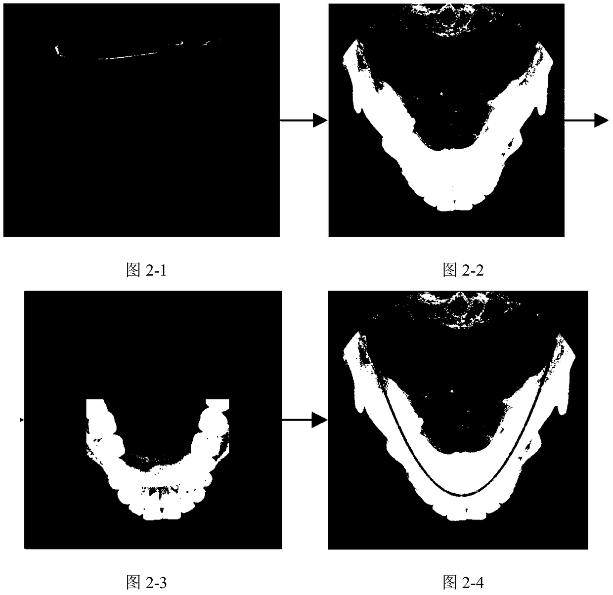 A method for panorama extraction from 3D dental cone-beam CT data