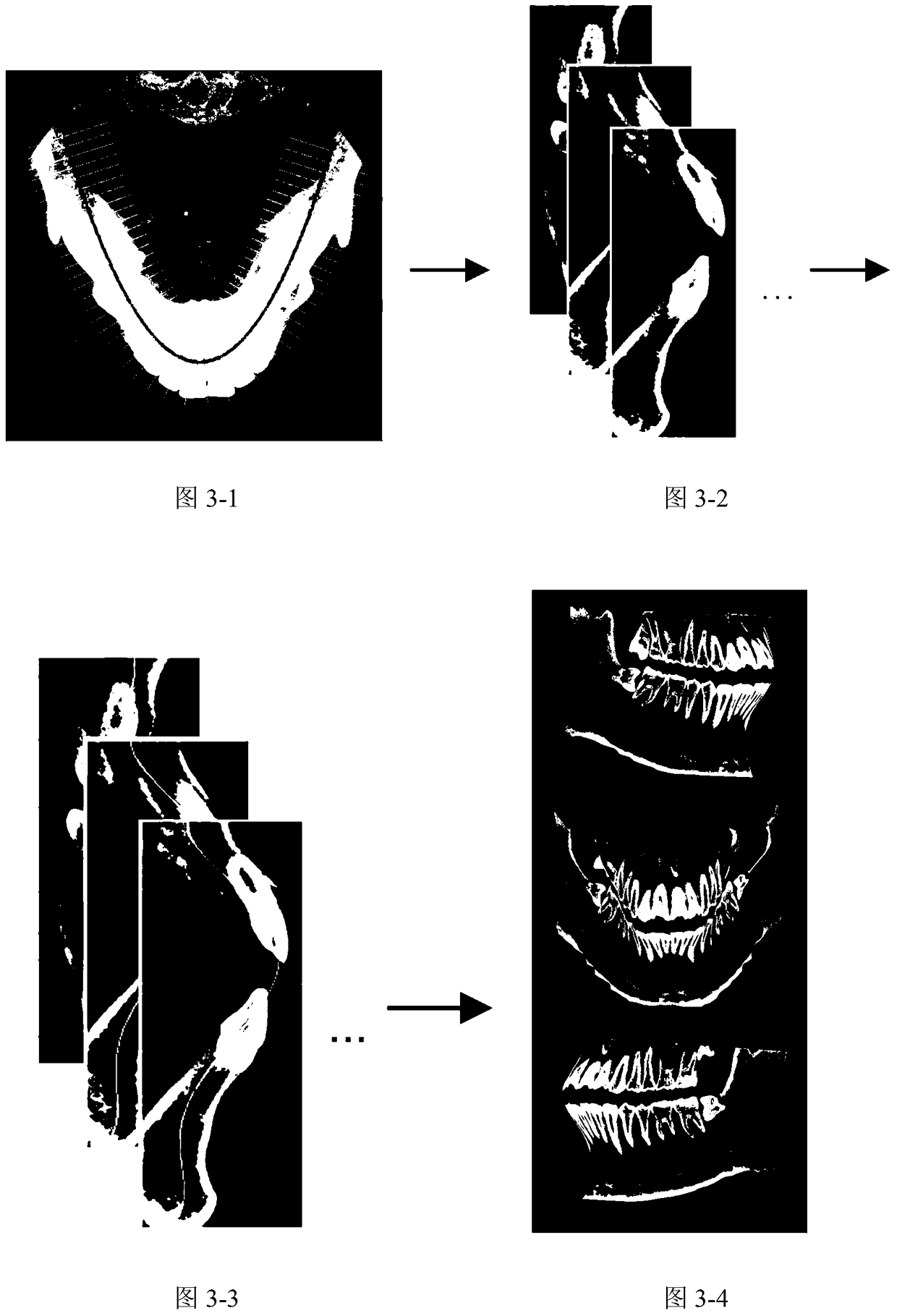 A method for panorama extraction from 3D dental cone-beam CT data