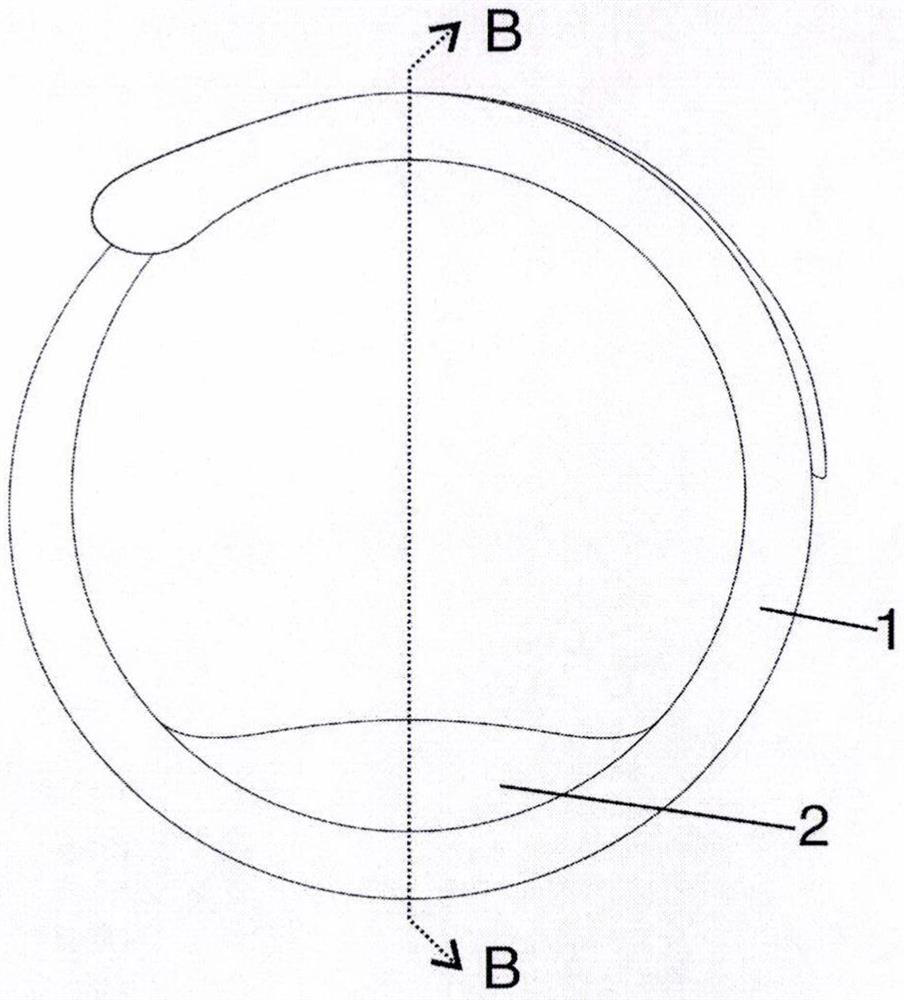 Contraceptive adjusting ring