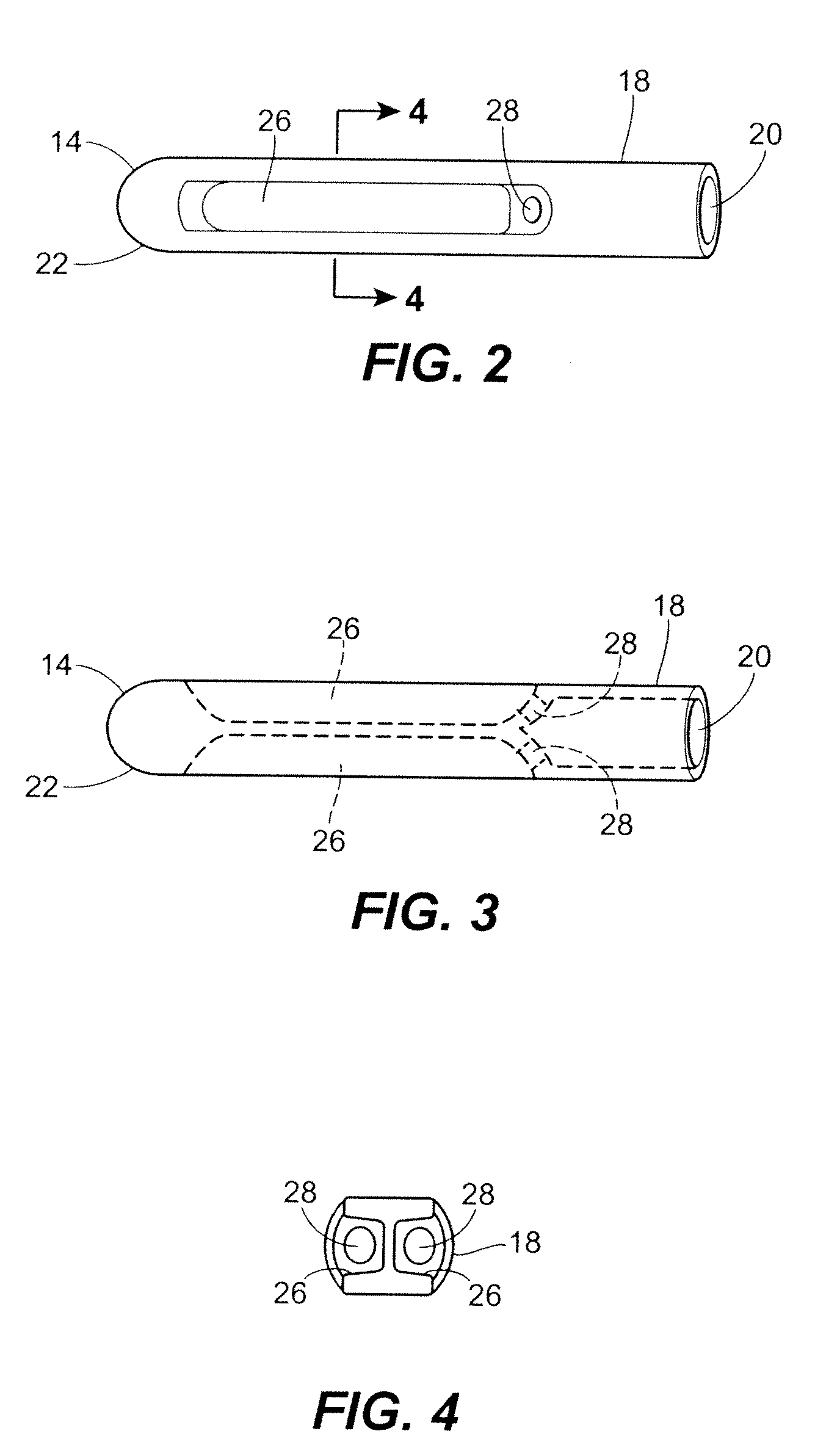 Fluid Drainage Catheter Having an External Flow Path