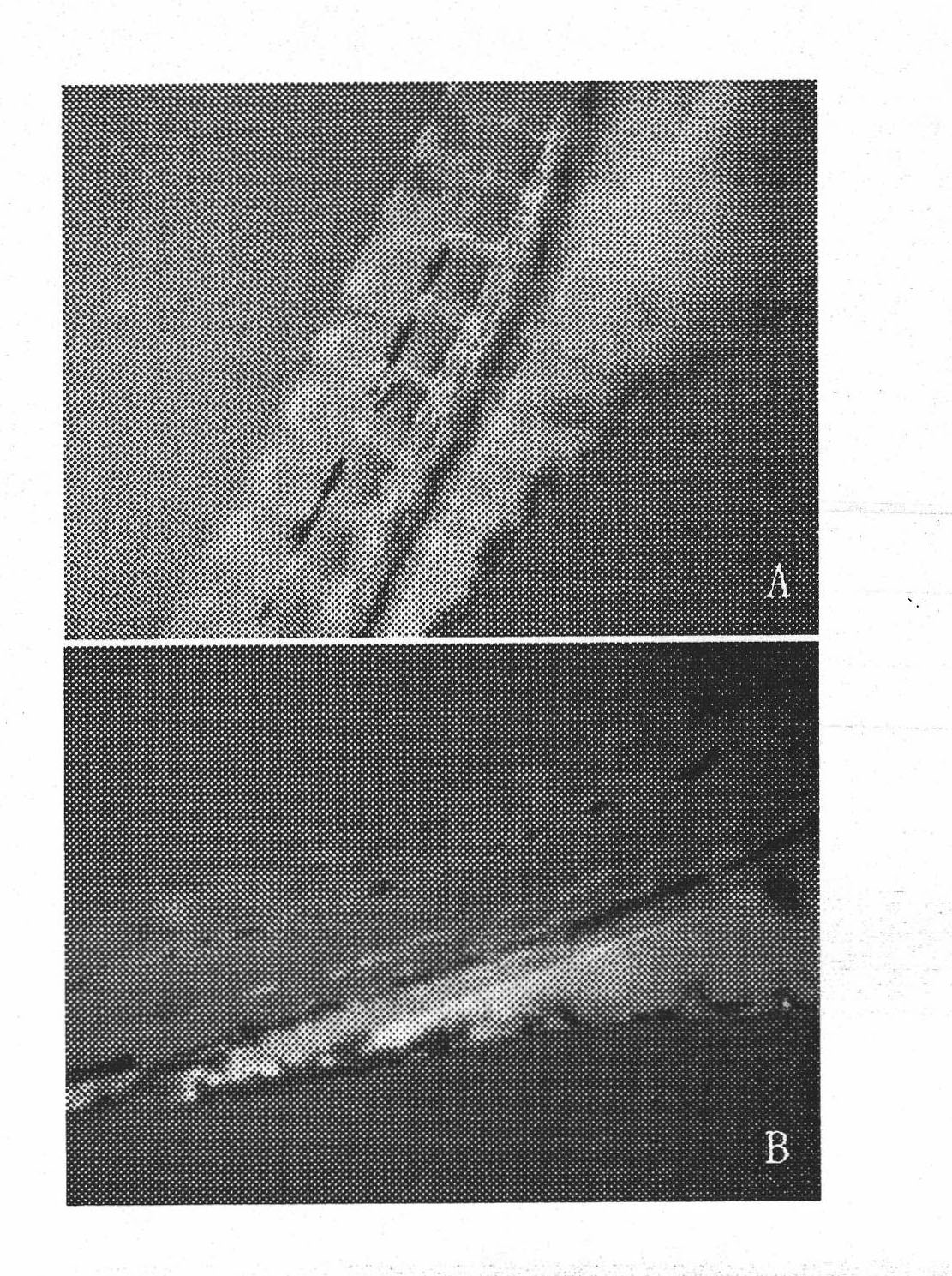 Antineoplastic medicine composition and application thereof