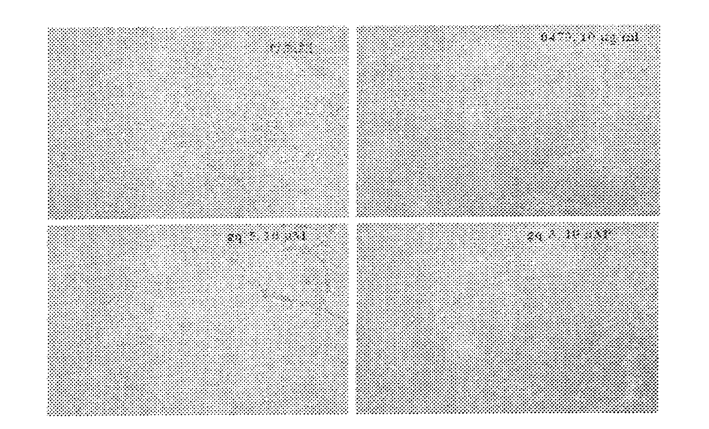 Urushiol compound and medicinal composition thereof, preparation method and application thereof