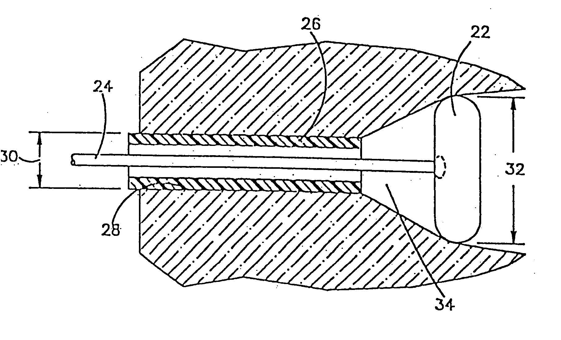 Fluid operated retractors